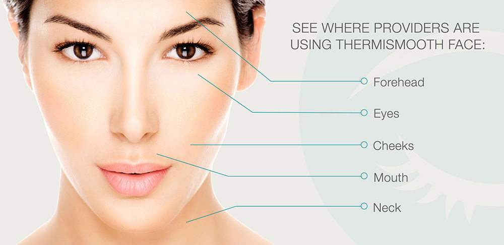 ThermiSmooth and Skin Tightening Harrison Township MI