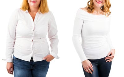 The truSculpt iD Approach to Fat Removal