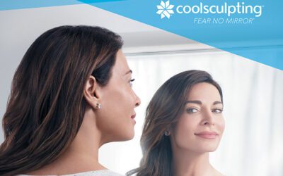 CoolSculpting Elite for Stubborn Fat Under Your Chin